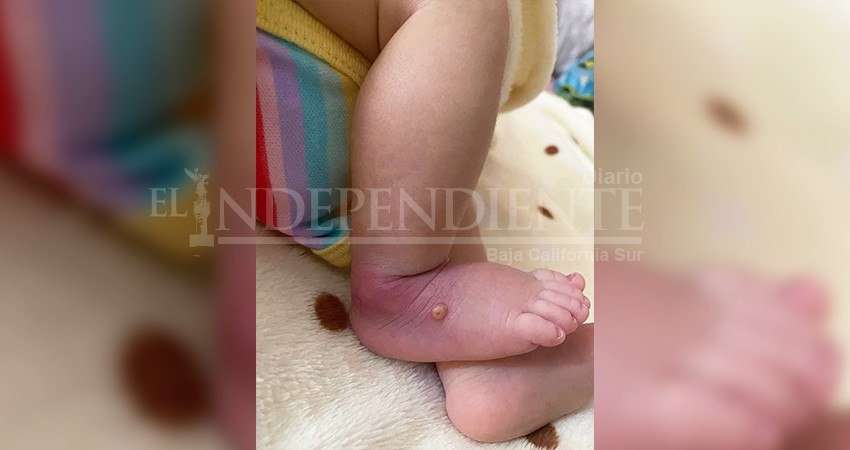 Denuncian que por negligencia médica del IMSS, perdió la vida de una recién nacida Denuncian que por negligencia médica del IMSS, perdió la vida de una recién nacida