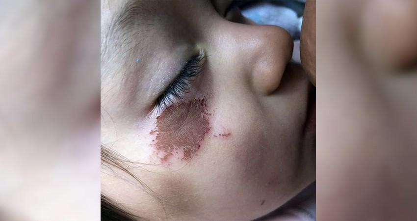 Denuncian a la estancia infantil “Mundo Rey 2” por maltrato infantil Denuncian a la estancia infantil “Mundo Rey 2” por maltrato infantil