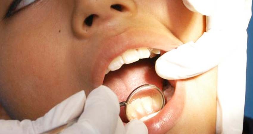 Fumar, mala higiene y sexo sin protección pueden provocar cáncer en la boca, alerta IMSS Fumar, mala higiene y sexo sin protección pueden provocar cáncer en la boca, alerta IMSS