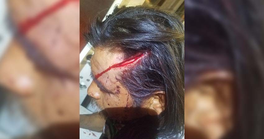 Le dio un machetazo en la cabeza “Por hablar de más”