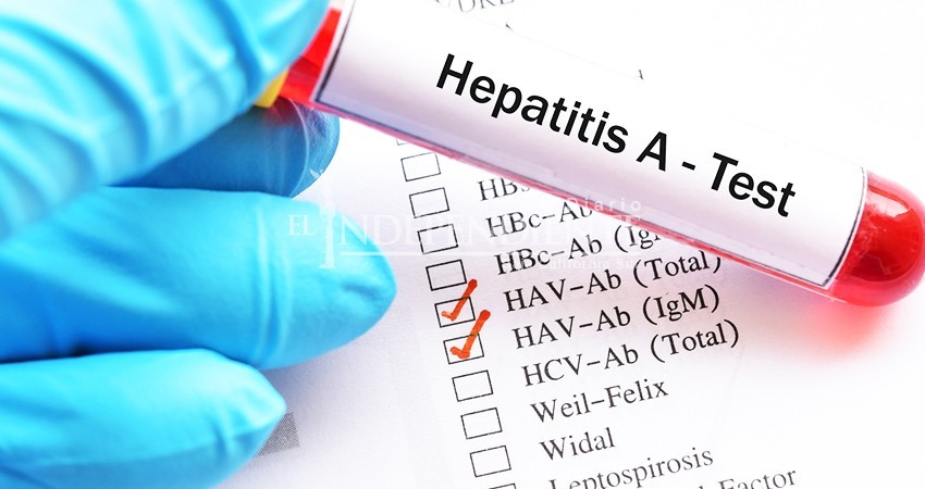 Reporta SSA ligero aumento de casos por Hepatitis A en Cabo San Lucas