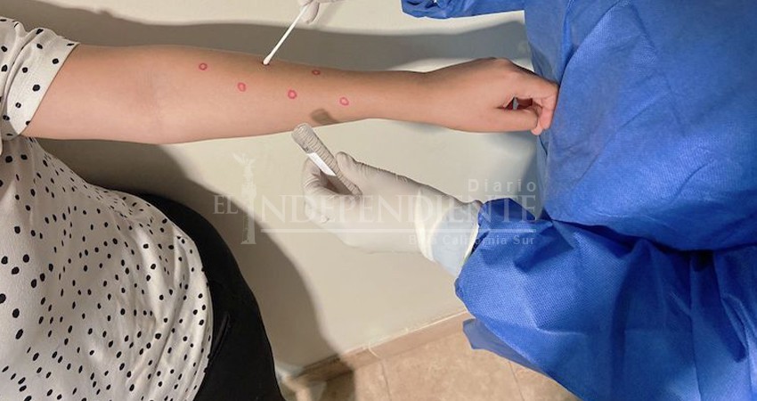 Un joven de 26 años de Los Cabos, el primer caso de viruela símica en BCS