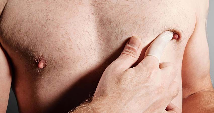 Cáncer de mama también se presenta en hombres trans y cisgénero: SSA Cáncer de mama también se presenta en hombres trans y cisgénero: SSA