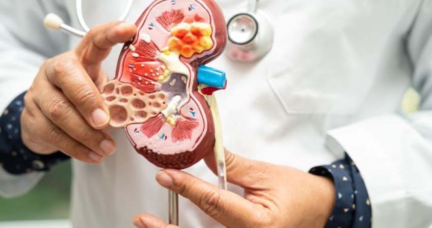 Alertan aumento de la enfermedad renal en México y urgen medidas preventivas