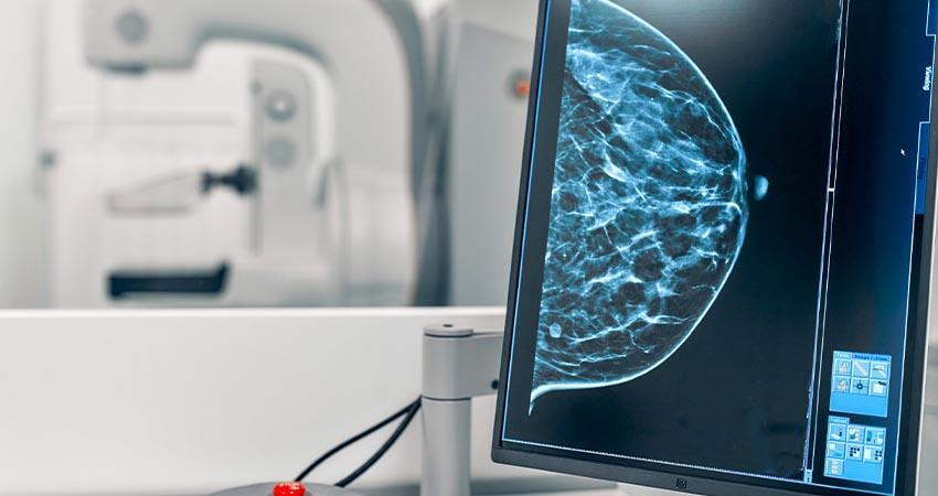 Invita UMF No. 6 del IMSS en SJC a mujeres de 40 a 69 años a realizarse estudio de mastografía