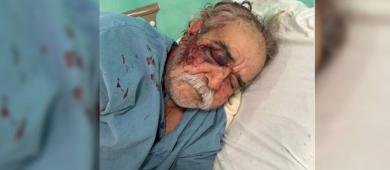 Inician investigación por “golpiza” a un adulto mayor en La Paz