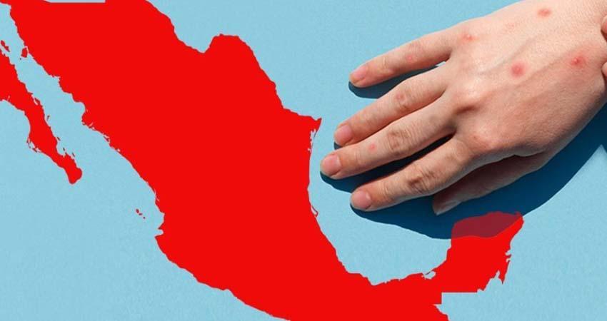 México, epicentro del brote de sarampión en América