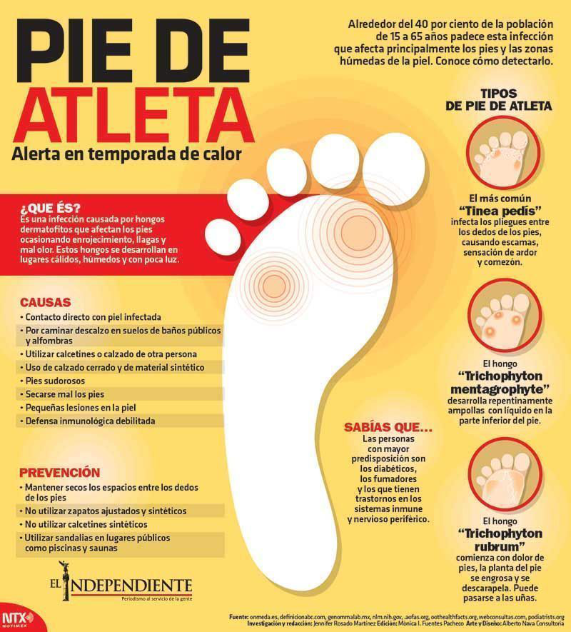 Pie de atleta
