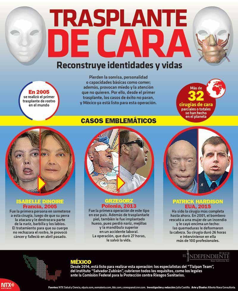 Trasnplante de cara copia