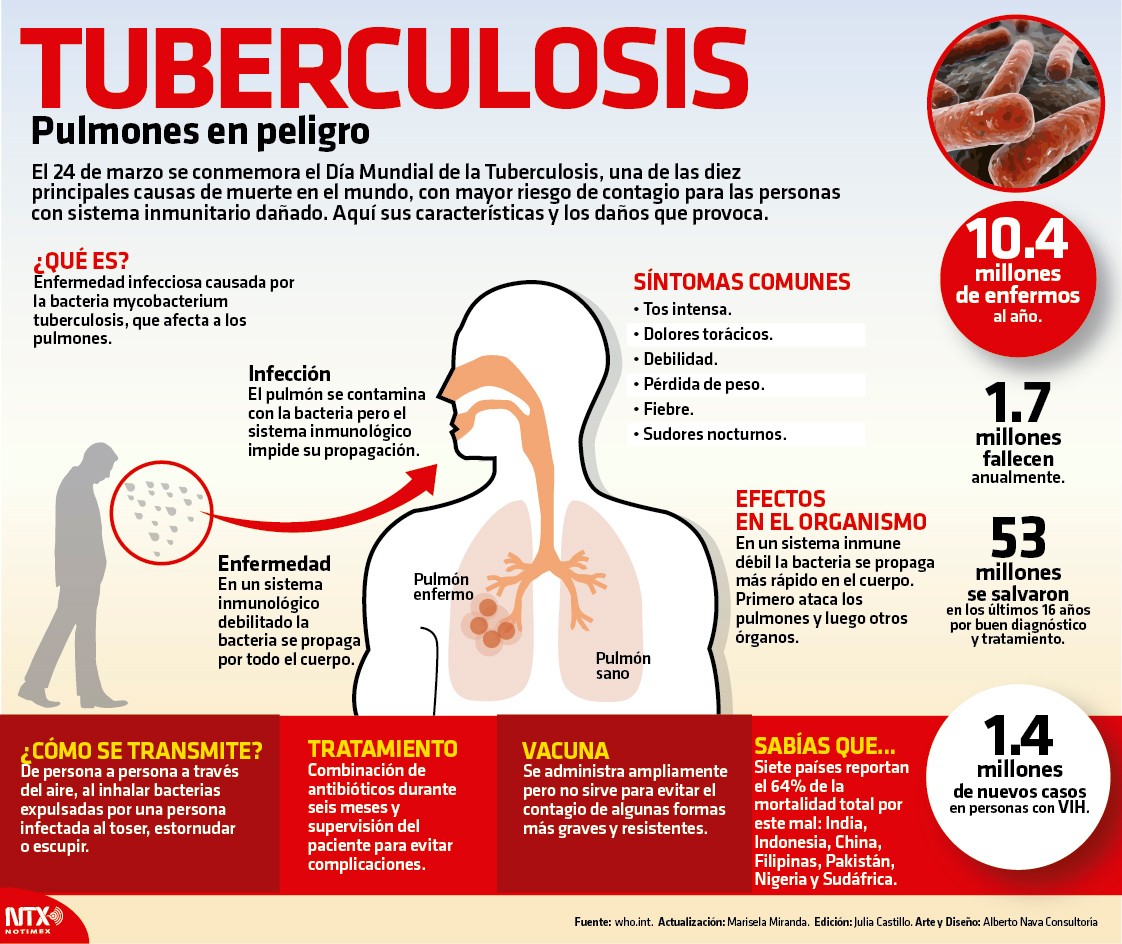 Tuberculosis