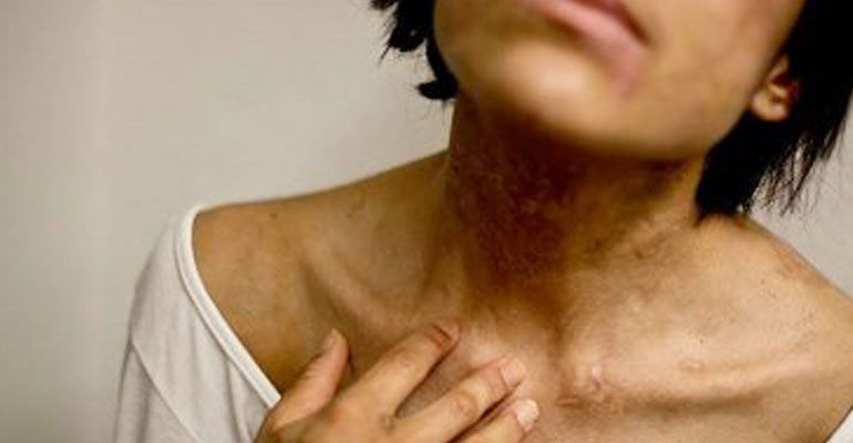 Hasta 70 años de cárcel para quienes esclavizaron a joven: Navarrete Prida