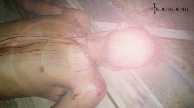 Hombre recibe brutal golpiza dentro de su domicilio en SJC