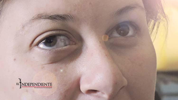 Lanzar huevos en Halloween me dejó ciega a los 17 años