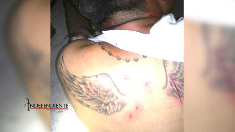 A navajazos lo agredieron en el centro de la ciudad