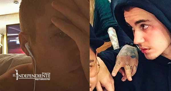 Justin Bieber se tatúa una cruz en el rostro
