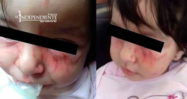 Denuncian maltrato a niña en estancia infantil de Morelia