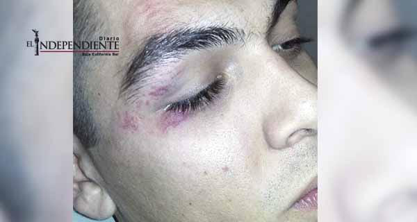 Brutal agresión recibió basquetbolista de La Paz por parte de su rival