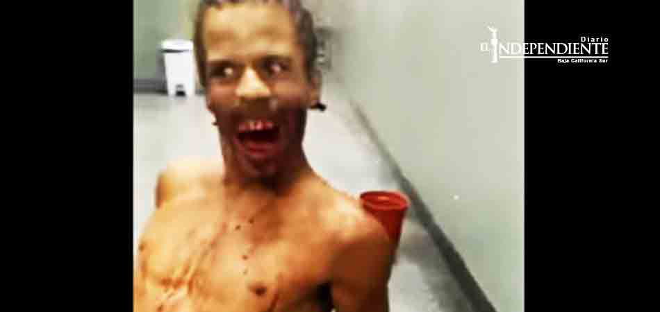 hombre 'poseído' en hospital de Brasil