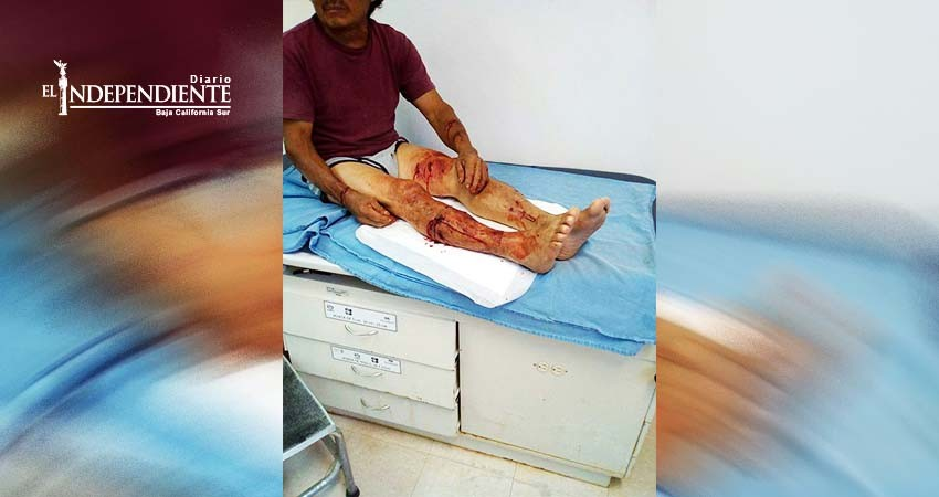 Hombre queda herido tras ser atacado por un perro en CSL 