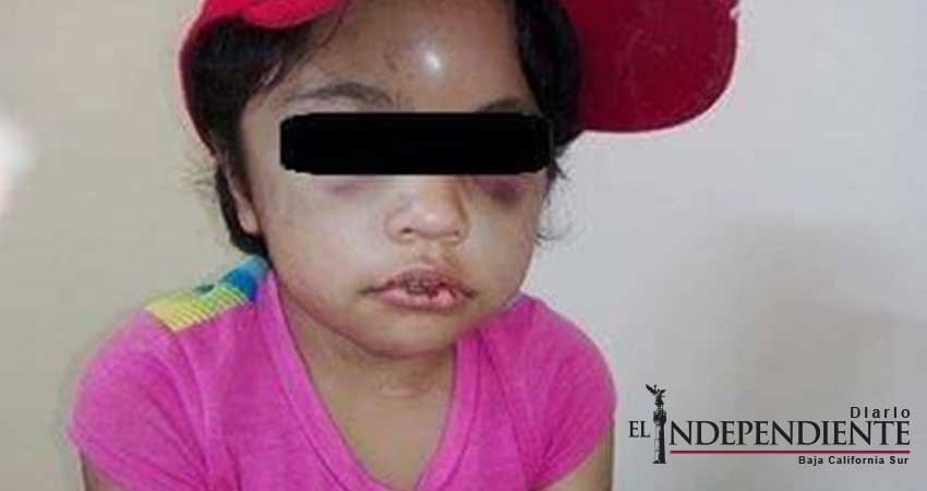 Sólo tiene siete años y sus padres casi la matan a golpes