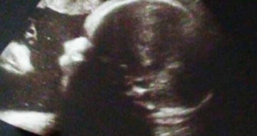 Ecografía espiritual; ven a Jesucristo junto a su bebé