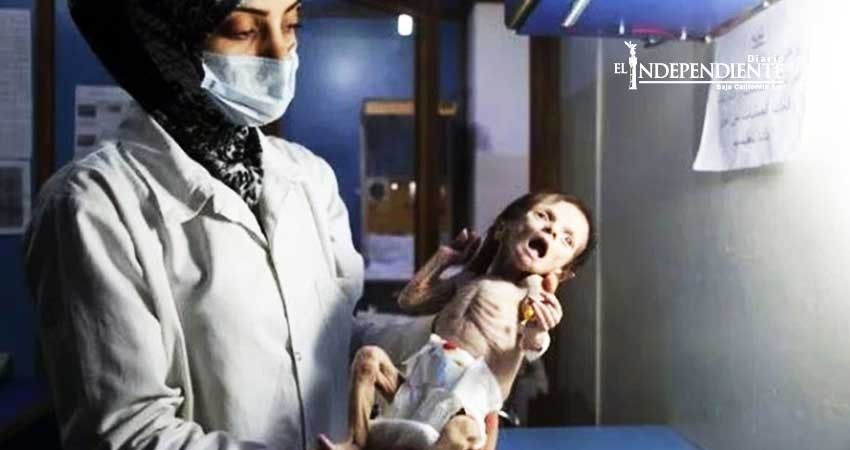 Sahar, la niña que murió de hambre en Siria por la guerra