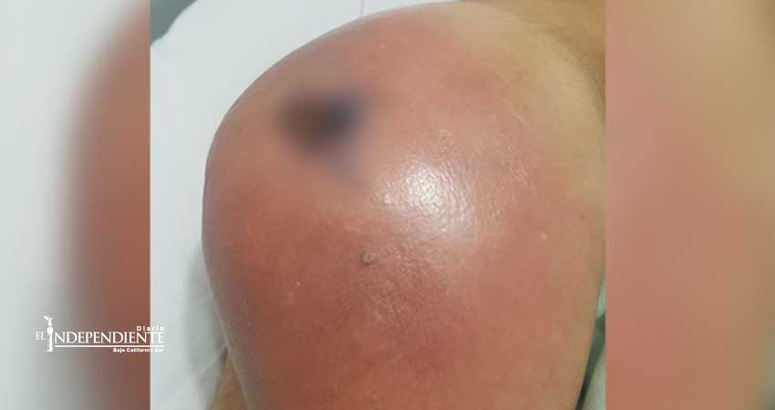 Falso curandero mata a un hombre con sustancia ‘mágica’