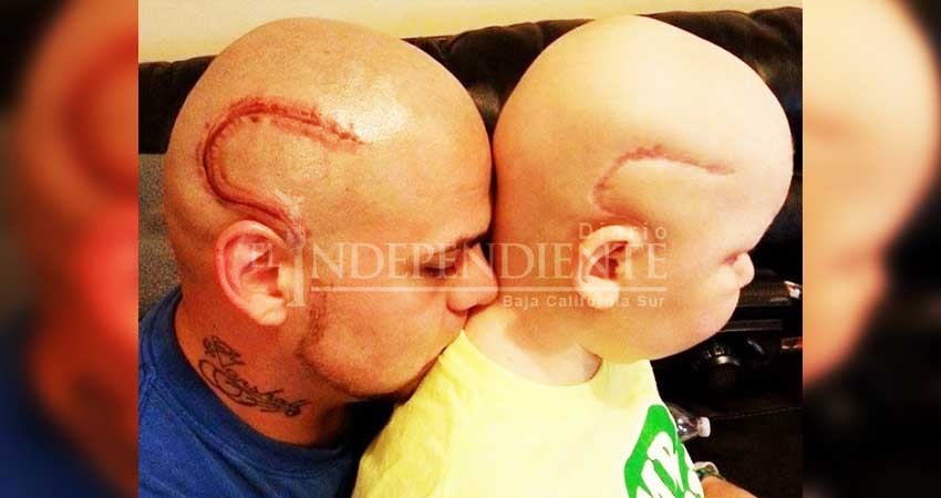 Muere niño cuyo padre se tatuó una cicatriz como la suya
