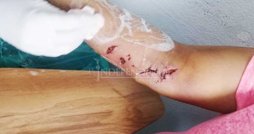 Casi matan a una señora unos Pitbulls en Cd Constitución