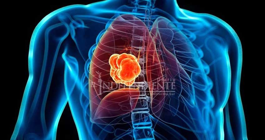 Cáncer de mama y pulmón, los más recurrentes en BCS