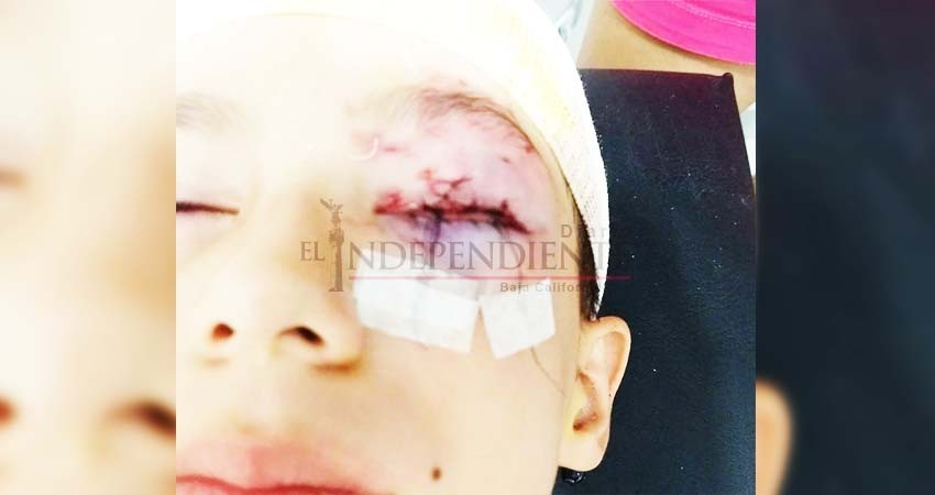 El pequeño André pide ayuda para solventar sus cirugías tras ataque de perro