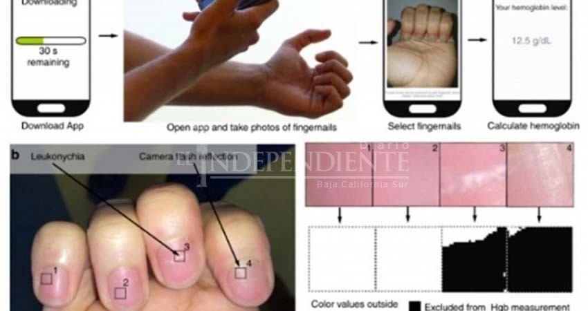 App es capaz de detectar anemia sólo con una foto de tu uña