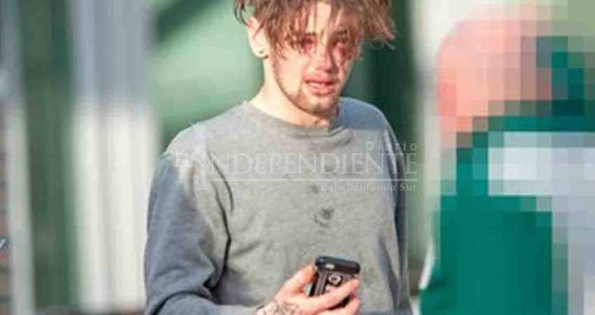 'No hice nada malo’, así respondió un joven que atropelló a un niño