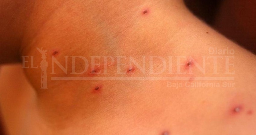 Los Cabos sin casos de sarampión, confirma Jurisdicción Sanitaria de Los Cabos