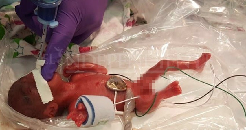 Nace la bebé más pequeña del mundo... ¡Pesa lo de una manzana!