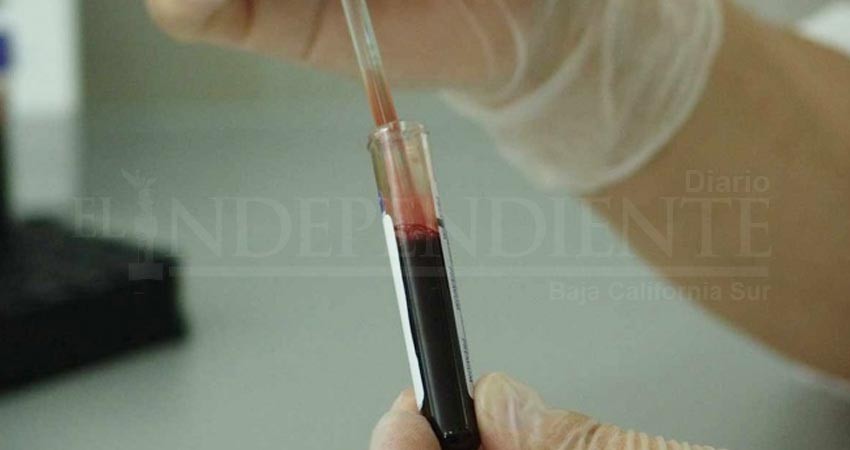 Le dan 10 años de cárcel por no avisar a parejas que tiene VIH