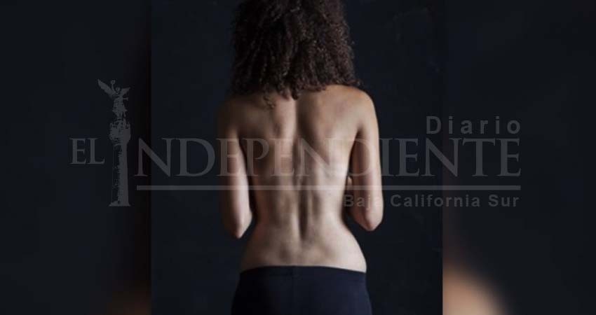 Instagram produce demanda de hoyuelos de Venus ficticios