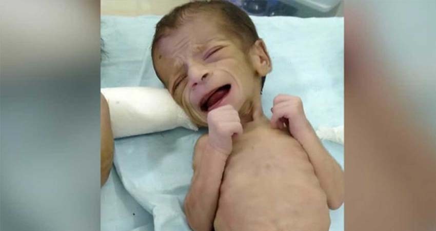 Rescatan de milagro a una recién nacida enterrada viva