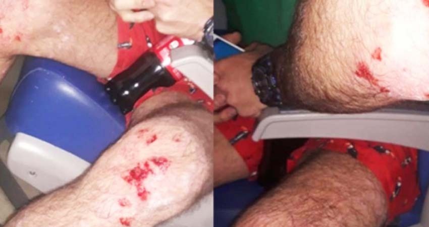 Latiguean a pareja gay por besarse en parque; así terminó el agresor