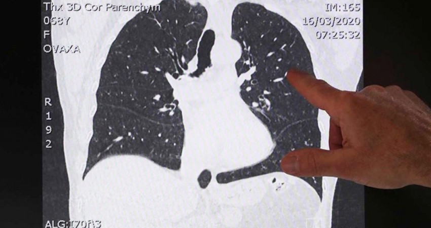 'Covid-19 infectará al 70% de la población mundial y duraría 2 años
