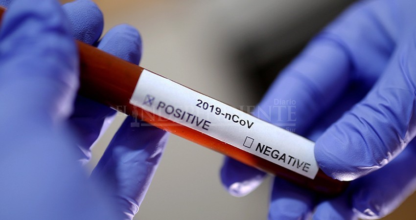 Suma BCS 129  infectados de COVID-19, entre ellos 5 muertos