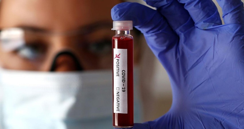 11 contagios más en BCS; la cifra se eleva a 194