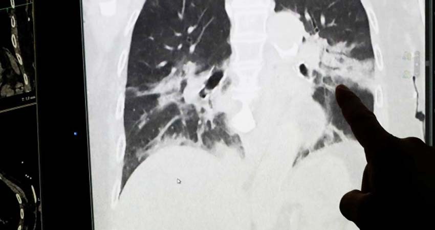 El coronavirus nos acompañará durante mucho tiempo: OMS