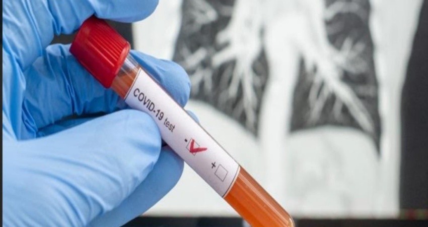 De nuevo, confirman más  casos de COVID-19 en BCS