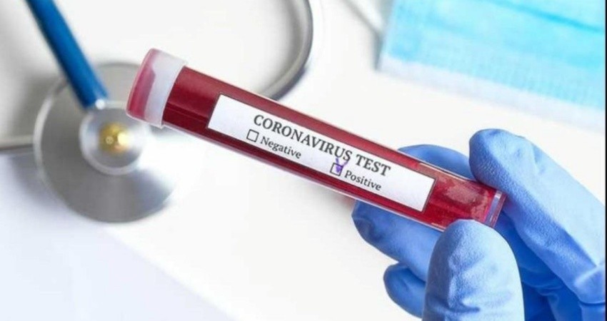 Confirman 5 casos más y una defunción por COVID-19 en BCS