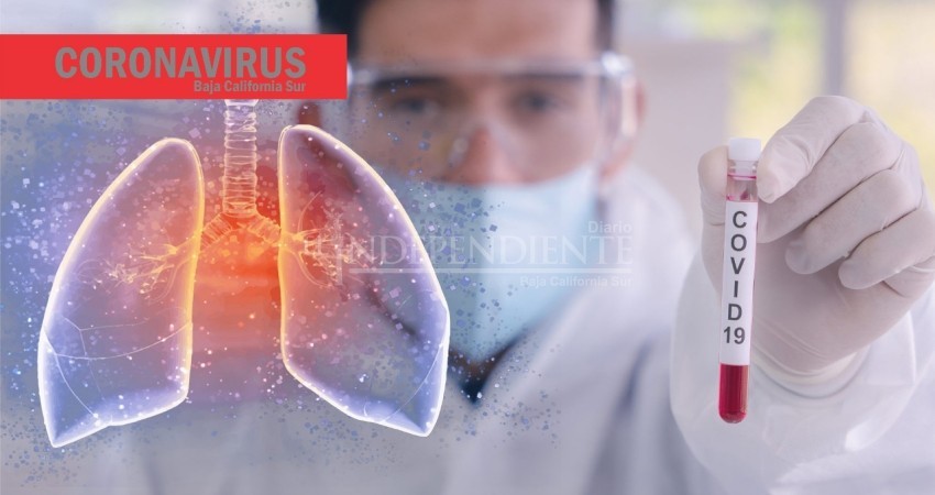 21 casos nuevos de COVID-19 en BCS este domingo, entre ellos los primeros de Loreto