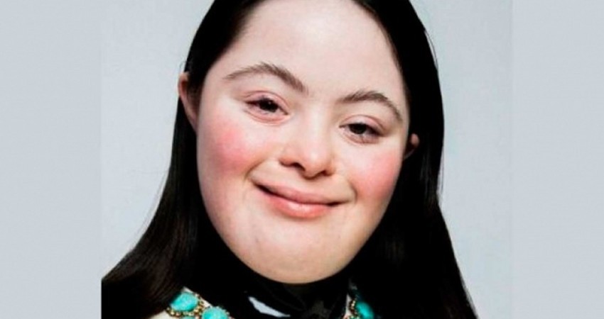 Ella es Ellie Goldstein, la nueva modelo de Gucci con síndrome de Down