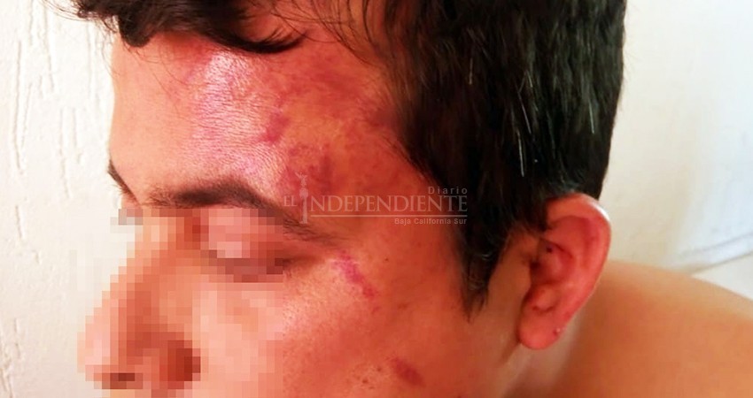 “Denuncié golpiza que me dio el subcomandante y a mí me removieron”: Policía municipal