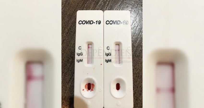 Pruebas rápidas COVID-19 no son seguras ni obligatorias para viajar por avión