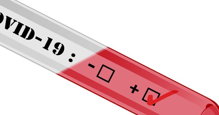 Crean método de prueba covid que te dice si estás contagiado en un segundo